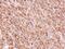 Tetratricopeptide Repeat Domain 30A antibody, NBP1-32574, Novus Biologicals, Immunohistochemistry paraffin image 