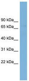 Glut8 antibody, TA333500, Origene, Western Blot image 