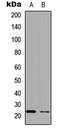 Apolipoprotein B MRNA Editing Enzyme Catalytic Subunit 3C antibody, LS-C354276, Lifespan Biosciences, Western Blot image 