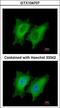 Stathmin 1 antibody, LS-B4830, Lifespan Biosciences, Immunofluorescence image 