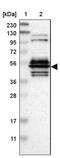 WD Repeat Domain 13 antibody, NBP1-85820, Novus Biologicals, Western Blot image 