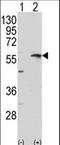 Matrix Metallopeptidase 13 antibody, LS-C100443, Lifespan Biosciences, Western Blot image 