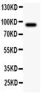 Activating Transcription Factor 6 antibody, PA1011-1, Boster Biological Technology, Western Blot image 