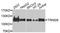 Tripartite Motif Containing 28 antibody, STJ111958, St John