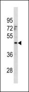 Mitochondrial Carrier 1 antibody, LS-C203884, Lifespan Biosciences, Western Blot image 