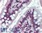 EWS RNA Binding Protein 1 antibody, LS-B3967, Lifespan Biosciences, Immunohistochemistry paraffin image 