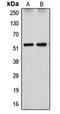Cytochrome P450 Family 26 Subfamily A Member 1 antibody, LS-C352102, Lifespan Biosciences, Western Blot image 