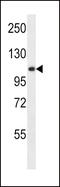 Lysosomal alpha-glucosidase antibody, 56-495, ProSci, Western Blot image 