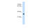 TAL BHLH Transcription Factor 1, Erythroid Differentiation Factor antibody, 31-245, ProSci, Western Blot image 