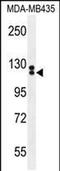 Tubulin polyglutamylase TTLL13 antibody, PA5-48213, Invitrogen Antibodies, Western Blot image 