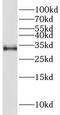 THAP Domain Containing 10 antibody, FNab08659, FineTest, Western Blot image 