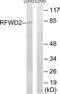 E3 ubiquitin-protein ligase RFWD2 antibody, TA315723, Origene, Western Blot image 