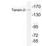 Tensin 2 antibody, LS-C200023, Lifespan Biosciences, Western Blot image 