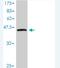 Phospholipase A And Acyltransferase 3 antibody, H00011145-M01, Novus Biologicals, Western Blot image 