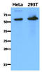 PDZ Domain Containing 1 antibody, AM50029PU-S, Origene, Western Blot image 
