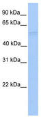 RuvB Like AAA ATPase 1 antibody, TA330264, Origene, Western Blot image 