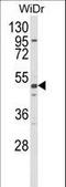 Aldehyde Dehydrogenase 5 Family Member A1 antibody, LS-C156266, Lifespan Biosciences, Western Blot image 