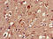 Clock Circadian Regulator antibody, CSB-PA005574EA01HU, Cusabio, Immunohistochemistry frozen image 