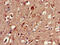 mCLOCK antibody, CSB-PA005574EA01HU, Cusabio, Immunohistochemistry frozen image 