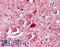 Parvalbumin antibody, LS-B3601, Lifespan Biosciences, Immunohistochemistry paraffin image 