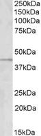 Rho GDP Dissociation Inhibitor Alpha antibody, orb20654, Biorbyt, Western Blot image 