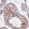 Ubiquitin Conjugating Enzyme E2 S antibody, NBP2-38822, Novus Biologicals, Immunohistochemistry paraffin image 