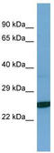 Tescalcin antibody, TA344953, Origene, Western Blot image 