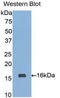 Sialic Acid Binding Ig Like Lectin 7 antibody, LS-C301388, Lifespan Biosciences, Western Blot image 