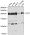 Clustered Mitochondria Homolog antibody, A11184, Boster Biological Technology, Western Blot image 