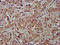 Fibulin 2 antibody, LS-C670167, Lifespan Biosciences, Immunohistochemistry paraffin image 