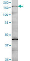 Collagen Type V Alpha 1 Chain antibody, LS-C196944, Lifespan Biosciences, Western Blot image 