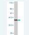 LIM Domain Only 1 antibody, H00004004-M06, Novus Biologicals, Western Blot image 