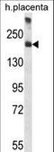 Alpha-2-macroglobulin antibody, LS-C155819, Lifespan Biosciences, Western Blot image 