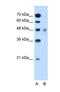 Solute Carrier Family 17 Member 4 antibody, NBP1-59883, Novus Biologicals, Western Blot image 