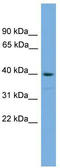 SAM Domain, SH3 Domain And Nuclear Localization Signals 1 antibody, TA338944, Origene, Western Blot image 