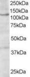 HPS3 Biogenesis Of Lysosomal Organelles Complex 2 Subunit 1 antibody, GTX19047, GeneTex, Western Blot image 