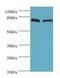 Solute Carrier Family 39 Member 6 antibody, LS-C377521, Lifespan Biosciences, Western Blot image 
