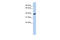 ADP Ribosylation Factor Like GTPase 13B antibody, 26-696, ProSci, Western Blot image 