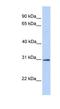 Ring Finger Protein 148 antibody, NBP1-59516, Novus Biologicals, Western Blot image 