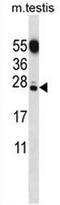 GID Complex Subunit 8 Homolog antibody, AP51108PU-N, Origene, Western Blot image 