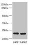 RAB17, Member RAS Oncogene Family antibody, LS-C676344, Lifespan Biosciences, Western Blot image 