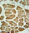 Carbonic Anhydrase 3 antibody, LS-C168240, Lifespan Biosciences, Immunohistochemistry paraffin image 