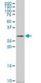 Carbonic Anhydrase 1 antibody, H00000759-M10, Novus Biologicals, Western Blot image 