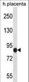 NLR Family Pyrin Domain Containing 6 antibody, LS-C162912, Lifespan Biosciences, Western Blot image 