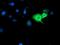 Interferon-induced guanylate-binding protein 1 antibody, MA5-25692, Invitrogen Antibodies, Immunocytochemistry image 