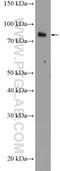 Exostosin Glycosyltransferase 2 antibody, 11348-1-AP, Proteintech Group, Western Blot image 