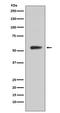 Carbonic Anhydrase 9 antibody, M01083-1, Boster Biological Technology, Western Blot image 