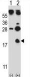 Hemoglobin Subunit Gamma 1 antibody, abx027543, Abbexa, Western Blot image 