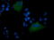 MDM4 Regulator Of P53 antibody, LS-B13608, Lifespan Biosciences, Immunofluorescence image 