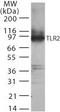 Toll Like Receptor 2 antibody, PA1-41480, Invitrogen Antibodies, Western Blot image 